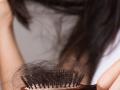 How To Control Hair Fall : केस खूप गळत आहेत, इतके की कापून टाकावेसे वाटतात? करा ३ उपाय; केसगळती होईल कमी - Marathi News | | Latest sakhi News at Lokmat.com