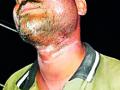 गळ्यात वीज तार लटकल्याने युवक गंभीर - Marathi News | Youth serious after hanging the electricity wire around the neck | Latest chandrapur News at Lokmat.com