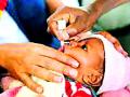 १ लाख ४ हजार बालकांना पोलिओचा डोज देणार - Marathi News | Polio dosage of 1 lakh 4 thousand children | Latest gondia News at Lokmat.com
