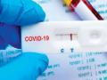 शहरात २५ हजार अ‍ॅँटिजेन टेस्ट ! - Marathi News | 25,000 antigen tests in the city! | Latest nashik News at Lokmat.com