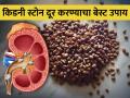 मोठ्यातला मोठा किडनी स्टोन तोडते ही डाळ, लघवीद्वारे सहज येईल बाहेर! - Marathi News | Kulith is best remedy for kidney stone | Latest health Photos at Lokmat.com