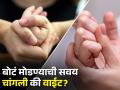 बोटं मोडण्याची सवय तुमच्यासाठी नुकसानकारक असते का? वाचा एक्सपर्टचा सल्ला - Marathi News | Is it bad to crack joints in your fingers cracking knuckles side effects | Latest health News at Lokmat.com