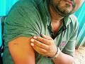 भाजपा कामगार जिल्हाध्यक्षावर हल्ला - Marathi News | BJP workers attacked | Latest chandrapur News at Lokmat.com