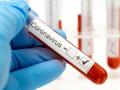 नंदुरबार जिल्ह्यातील २२ जणांना कोरोनाचा संसर्ग - Marathi News | 22 infected with corona in Nandurbar district | Latest nandurbar News at Lokmat.com