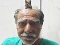 डोके आदळू नका, शिंग उगवेल....अरेच्चा खरेच उगवले की! - Marathi News | Shocking...! horn grown on head of 74 year old man in madhya pradesh | Latest national News at Lokmat.com