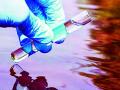 सावधान, 199 गावांमध्ये पिण्याचे पाणीच ठरू शकते आजाराचे कारण ! - Marathi News | Beware, only drinking water in 199 villages can be the cause of the disease! | Latest yavatmal News at Lokmat.com