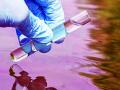 जिल्ह्यातील 663 ठिकाणचे पिण्याचे पाणी देत आहेत आजाराला आमंत्रण - Marathi News | Drinking water of 663 places in the district is inviting diseases | Latest gadchiroli News at Lokmat.com