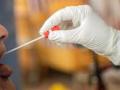आतापर्यंत घेतले अडीच हजार स्वॅब - Marathi News | Two and a half thousand swabs taken so far | Latest nandurbar News at Lokmat.com