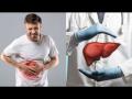Liver कमजोर होण्याआधी शरीर देतं हे संकेत, वेळीच व्हा सावध नाही तर... - Marathi News | Liver damage disease symptoms warning sign of Liver damage | Latest health News at Lokmat.com