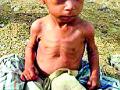 जिल्ह्यात २२८ बालके तीव्र कुपोषित - Marathi News | In the district 228 children are severely malnourished | Latest gondia News at Lokmat.com