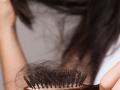 केस गळून गळून पातळ झाले? वापरा १ खास तेल, लांबसडक वाढतील केस-दिसाल सुंदर - Marathi News | Home made Ayurvedic hair oil for hair growth : Hair loss and thinning? Use 1 special oil, hair will grow long and look beautiful | Latest sakhi News at Lokmat.com