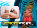 7 लक्षण सांगतात लास्ट स्टेजमध्ये आहे डायबिटीस, आतून सडलं आहे शरीर - Marathi News | Symptoms of end or last stage diabetes in men and women you should know | Latest health Photos at Lokmat.com