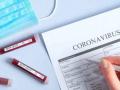 Corona Virus in Chandrapur; 'त्या' रुग्णाच्या वैद्यकीय अहवालावरून अधिकारी बुचकळ्यात - Marathi News | The medical officer was confused by the medical report of the patient | Latest chandrapur News at Lokmat.com