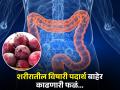 आतड्यांची स्वच्छता करण्यासाठी नियमित खा 'ही' फळं, लगेच दूर होतील अनेक समस्या... - Marathi News | According to Ayurveda eat these fiber rich fruits to clean colon naturally | Latest health News at Lokmat.com