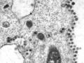 Coronavirus News: ठाणे जिल्ह्यात एक हजार ५८५ नवीन कोरोना रुग्ण : ३५ जणांचा मृत्यू - Marathi News | Coronavirus News: One thousand 585 new corona patients in Thane district: 35 died | Latest thane News at Lokmat.com