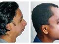 'तो' तब्बल ३० वर्षांनंतर झोपला अन् आईने पेढेच वाटले! - Marathi News | He was not asleep for 30 years ... | Latest nagpur News at Lokmat.com