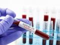 Corona virus : पिंपरी शहरात सोमवारी दिवसभरात आढळले हजार कोरोनाबाधित रूग्ण - Marathi News | Corona virus : Thousands of corona-infected patients were found in Pimpri city on Monday | Latest pimpri-chinchwad News at Lokmat.com