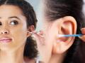 How To Clean Ear : कानात खूप मळ झालाय? ४ सोपे उपाय, कान सांभाळा- चुकीचे प्रयोग टाळा - Marathi News | How To Clean Ear: Too Much Ears? 4 simple solutions, take care of your ears - avoid wrong experiments | Latest sakhi News at Lokmat.com