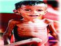 ८३ तीव्र तर २५० मध्यम कुपोषित बालके - Marathi News | 83 acute and moderately malnourished children | Latest nashik News at Lokmat.com