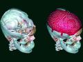 पहिल्यांदाच केली कवटीची ७५ टक्के पुुनर्रचना! - Marathi News | 75% of skulls reconstructed for the first time! | Latest nagpur News at Lokmat.com