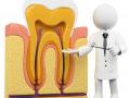 रुट कॅनलमध्ये नवा शोध - Marathi News | New search in the root canal | Latest nagpur News at Lokmat.com