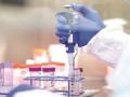 २४ तासात झाल्या कोरोनाच्या हजार चाचण्या - Marathi News | Thousands of corona tests performed in 24 hours | Latest nandurbar News at Lokmat.com