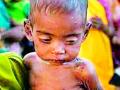कुपोषणाचे प्रमाण वाढले - Marathi News | Malnutrition increased | Latest yavatmal News at Lokmat.com