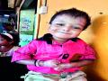 धक्कादायक! जीव टांगणीला, तरी म्हणे ५४ टक्के अपंगत्व.. - Marathi News | 54 percent disability certificate given to 8 year old boy by Aundh Hospital | Latest pune News at Lokmat.com