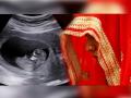 काय सांगता! लग्नाच्या दीड महिन्यानंतर नव्या नवरीची बिघडली तब्येत, चेक केलं तर निघाली 4 महिन्यांची गर्भवती - Marathi News | Groom finds his bride is 4 month pregnant after one month of marriage | Latest crime Photos at Lokmat.com