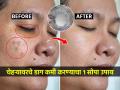 चेहऱ्यावरचे डाग घालवण्यासाठी ब्रँडेड क्रिम कशाला? घरीच करा १ खास क्रिम, चेहरा होईल उजळ - Marathi News | Easy Home Remedy to Remove Pigmentation, Dark Spot, Acne, Dark Circle : Why Branded Face Creams? Make 1 special cream at home, the face will be brighter | Latest sakhi News at Lokmat.com
