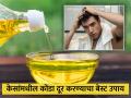 डोक्यावर चिकटून बसलेला डॅंड्रफ होईल लगेच दूर, कापरासोबत मिक्स करा या 2 गोष्टी! - Marathi News | Camphor kapoor and lemon juice natural Ayurvedic remedies to control dandruff | Latest health News at Lokmat.com