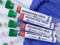 मंकीपॉक्सचा लैंगिक संबंधाशी काय ‘संबंध’? - Marathi News | What does monkeypox have to do with sex? | Latest health News at Lokmat.com