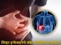 World Liver Day : लिव्हरला इन्फेक्शन झालं हे कसं ओळखाल? जाणून घ्या बचावाचे उपाय... - Marathi News | World Liver Day : How to prevent liver infection know its symptoms and prevention | Latest health Photos at Lokmat.com