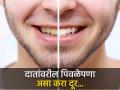दातांवरील पिवळेपणा घालवण्यासाठी खास नॅच्युरल उपाय, तोंडाचा येणार नाही वास! - Marathi News | 5 effective Ayurveda home remedies to remove yellow tartar from teeth | Latest health News at Lokmat.com