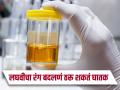 उन्हाळ्यात लघवीचा रंग जास्त पिवळा दिसतो का? 'या' असू शकतात समस्या... - Marathi News | Urine Color : Causes of yellow urine in summer season | Latest health News at Lokmat.com