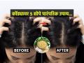 केसांतला कोंडा कमीच होत नाही? आजीबाई सांगतात ५ पारंपरिक उपाय, कोंडा होईल गायब... - Marathi News | Easy home remedies for Dandruff problem : Dandruff in the hair does not decrease? Grandma says 5 traditional remedies, dandruff will disappear... | Latest sakhi News at Lokmat.com