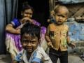 Coronavirus:...म्हणून भारतातल्या ५ कोटींहून जास्त लोकांना कोरोना लागण होण्याचा जास्त धोका - Marathi News | Coronavirus: More Than Five Crore Indians Do Not Have Facilities To Wash Hands pnm | Latest health Photos at Lokmat.com