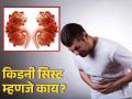'या' गोष्टींवरून मिळतात किडनी सिस्ट झाल्याचे संकेत, जाणून घ्या काय आहे ही समस्या! - Marathi News | Signs, causes and symptoms of kidney cyst | Latest health News at Lokmat.com