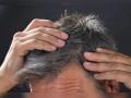 White Hair Problem: या तीन घरगुती उपायांनी दूर करा पांढऱ्या केसांची समस्या, जाणून घ्या पद्धत... - Marathi News | White hair problem use Aloe vera, curry leaves for again black hairs | Latest health News at Lokmat.com