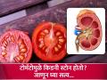 टोमॅटो खाल्ल्याने खरंच किडनी स्टोन होतो का? वाता कितपत आहे यात तथ्य - Marathi News | Can eating tomatoes cause kidney stones? Know The truth | Latest health News at Lokmat.com