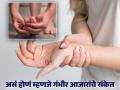 हात आणि पायांमध्ये झिणझिण्या येतात? या गंभीर आजारांचे असू शकतात संकेत - Marathi News | Tingling in hands and feet you should know the reason | Latest health News at Lokmat.com