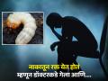 नाक-ओठ सुजले, नाकातून रक्त येत होतं; डॉक्टरांनी चेक केल्यावर नाकात दिसल्या 150 अळ्या - Marathi News | Doctor finds 150 live bugs inside patients nose after man complains of frequent nosebleeds | Latest jarahatke News at Lokmat.com