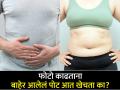 फोटो काढताना पोट आत खेचाल तर फुप्फुसं होतील खराब, त्याऐवजी करा हे काम - Marathi News | Lungs and stomach will damage if you pull stomach inside to look slim | Latest health Photos at Lokmat.com