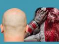 नवरदेव चक्कर येऊन पडला अन् त्याचा विग मेहुण्याच्या हातात आला, नवरीने लग्नास दिला नकार - Marathi News | Bride refused to marriage with head shave groom after wedding function in Unnao | Latest jarahatke News at Lokmat.com
