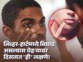 तुमचा चेहरा देत असतो अनेक गंभीर आजारांचे संकेत, कशी जाणून घ्याल काय समस्या आहे? - Marathi News | Your face is giving signs of many serious diseases, how do you know what is the problem? | Latest health News at Lokmat.com