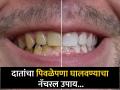 दात पिवळे असल्याने चारचौघात हसताही येत नाही? हा सोपा उपाय करून दात करा चमकदार! - Marathi News | Use mulethi powder and curd for teeth whitening home remedies | Latest health News at Lokmat.com