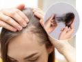 How To Control Hair Fall : केस खूप गळत आहेत, इतके की कापून टाकावेसे वाटतात? करा ३ उपाय; केसगळती होईल कमी - Marathi News | How To Control Hair fall: Hair is falling out so much that you want to cut it? Do 3 solutions; Hair loss will be reduced | Latest sakhi News at Lokmat.com