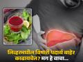 लिव्हरमधील कचरा बाहेर फेकतील हे खास ड्रिंक्स, लिव्हर कधीच होणार नाही खराब! - Marathi News | World Liver Day : 7 liver detox drinks which will clean liver inside out | Latest health Photos at Lokmat.com