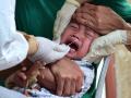 Coronavirus: कोरोना संबधित रहस्यमय रोगाचा लहान मुलांना धोका; अमेरिकेसह अनेक देश चिंतेत! - Marathi News | children getting severely symptoms similar to Kawasaki disease and toxic shock-like syndrome pnm | Latest international Photos at Lokmat.com