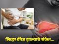 'या' लक्षणांवरून जाणून घ्या तुमचं लिव्हर होत आहे डॅमेज, वेळीच व्हा सावध! - Marathi News | Liver Damage Symptoms : How body parts tell your liver is not functioning properly | Latest health Photos at Lokmat.com